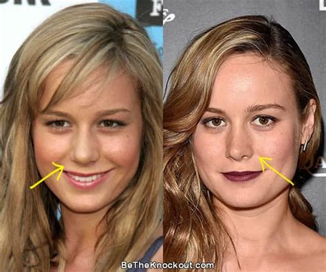 did brie larson have a boob job|Brie Larson Plastic Surgery: Nose job, Boob Job,。